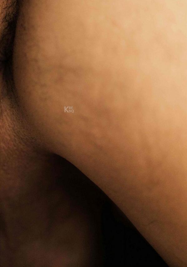 PAUSE-XX-02